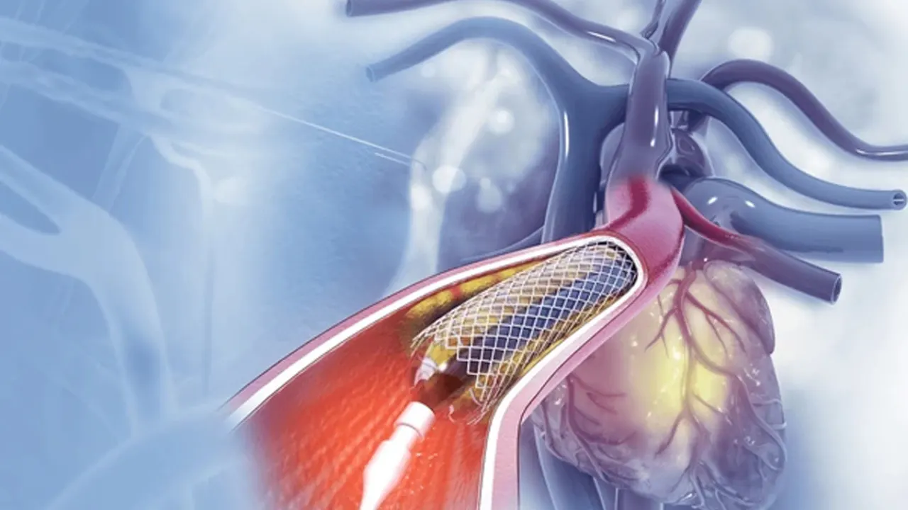 Anjiyo Ücreti 2026 Ne Kadar? Devlet ve Özel Hastanelerde Anjiyo Fiyatları, SGK Karşılıyor mu? Kalp Stent Ücretleri ve Üniversite Hastaneleri Güncel Fiyat Rehberi