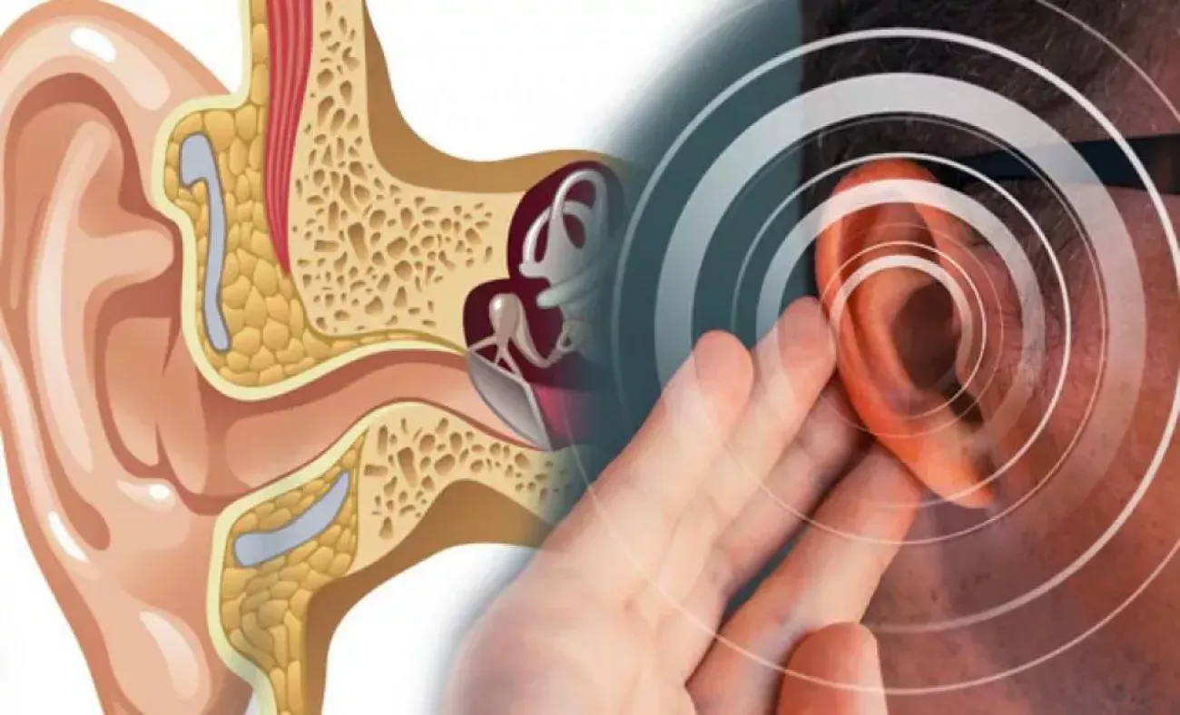 Meniere Hastalığı nedir? Meniere hastalığının belirtileri nelerdir? Meniere hastalığının nedenleri nelerdir? Meniere hastalığının tanısı nasıl konulur? Meniere hastalığı nasıl tedavi edilir? Meniere hastalığı için hangi egzersizler yapılmalıdır?