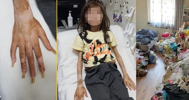 Bursa’da çöp evde bulunan Cem Muhammet’in son hali