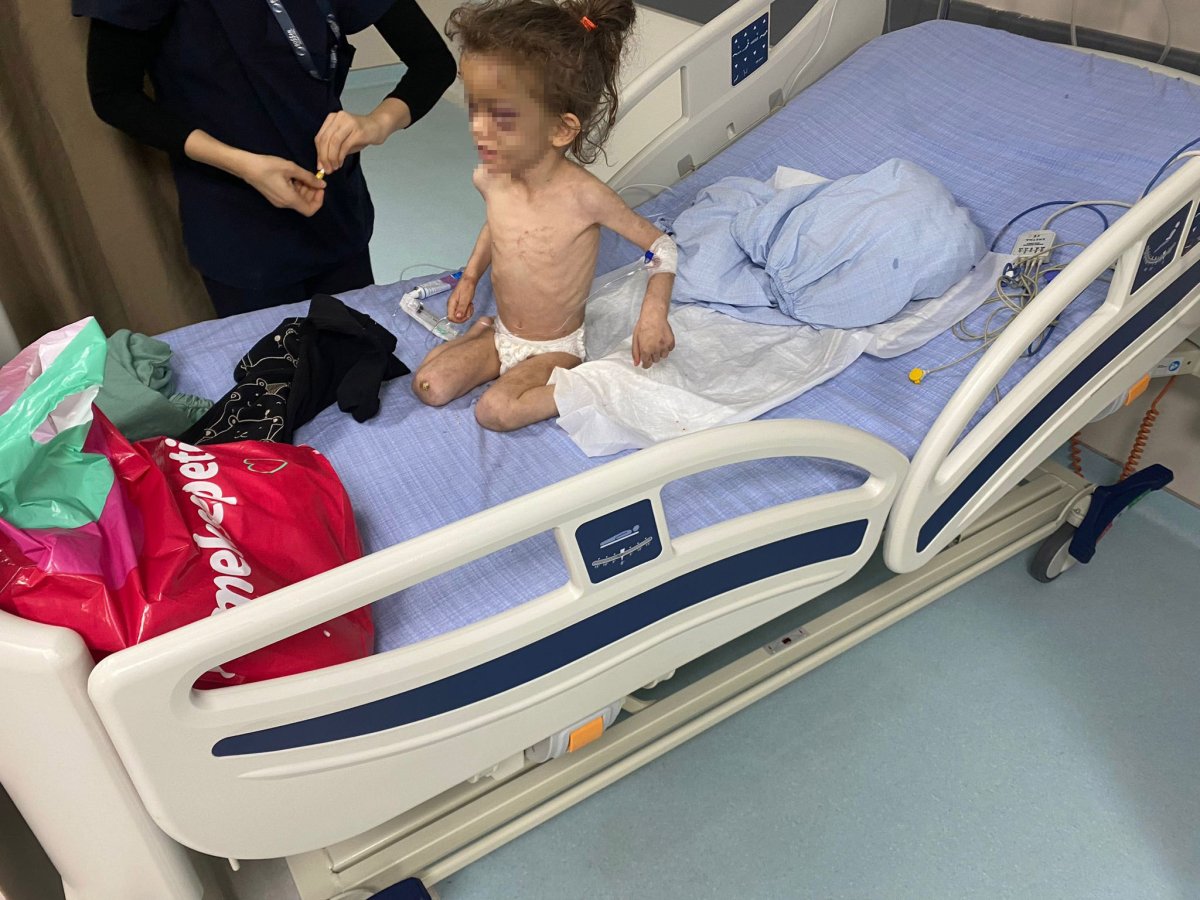 Gaziantep'te yürek burkan dram! 5 yaşındaki evladına işkence edip, günlerce aç bıraktı