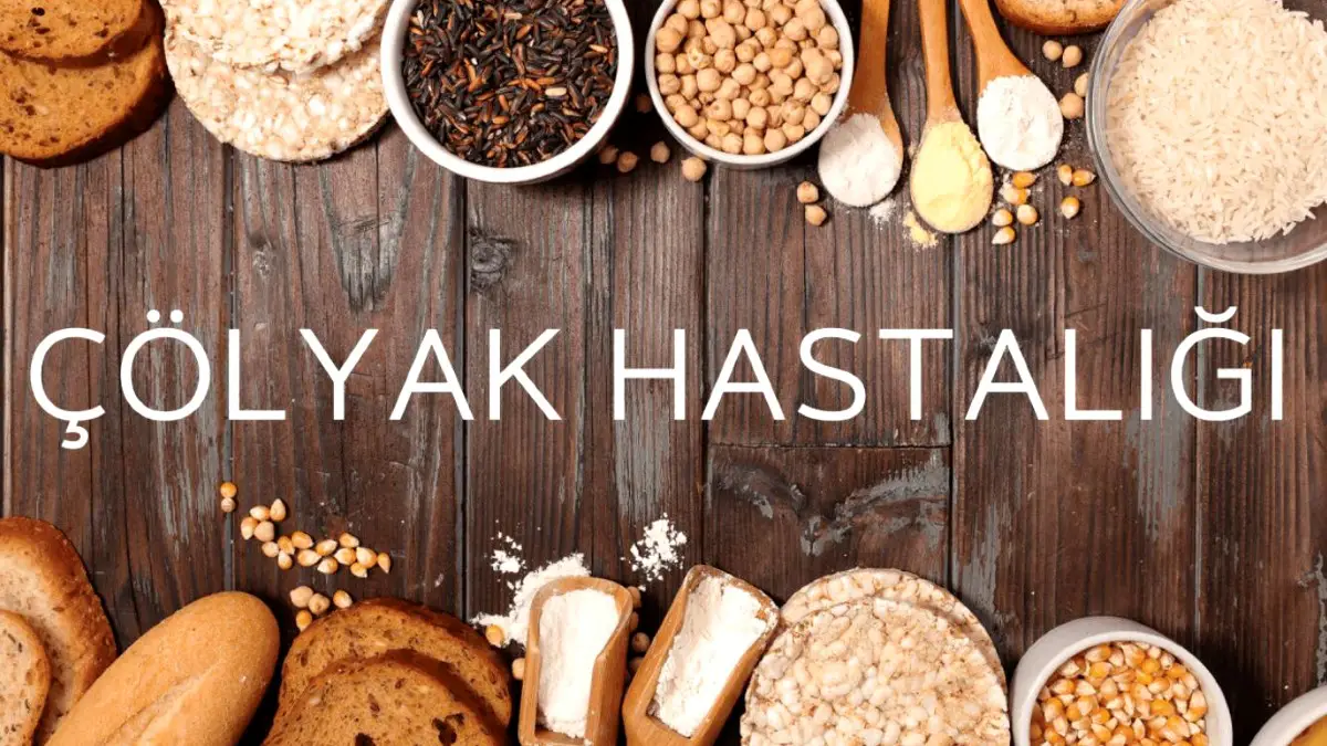 Çölyak hastalığı nedir? Çölyak hastalığı belirtileri nelerdir? Çölyak hastalığı tanısı nasıl konur? Çölyak hastalığının tedavisi nedir? Çölyak hastalığının nedenleri nelerdir? Çölyak hastalığının Yetişkinlerde görülen belirtileri nelerdir?