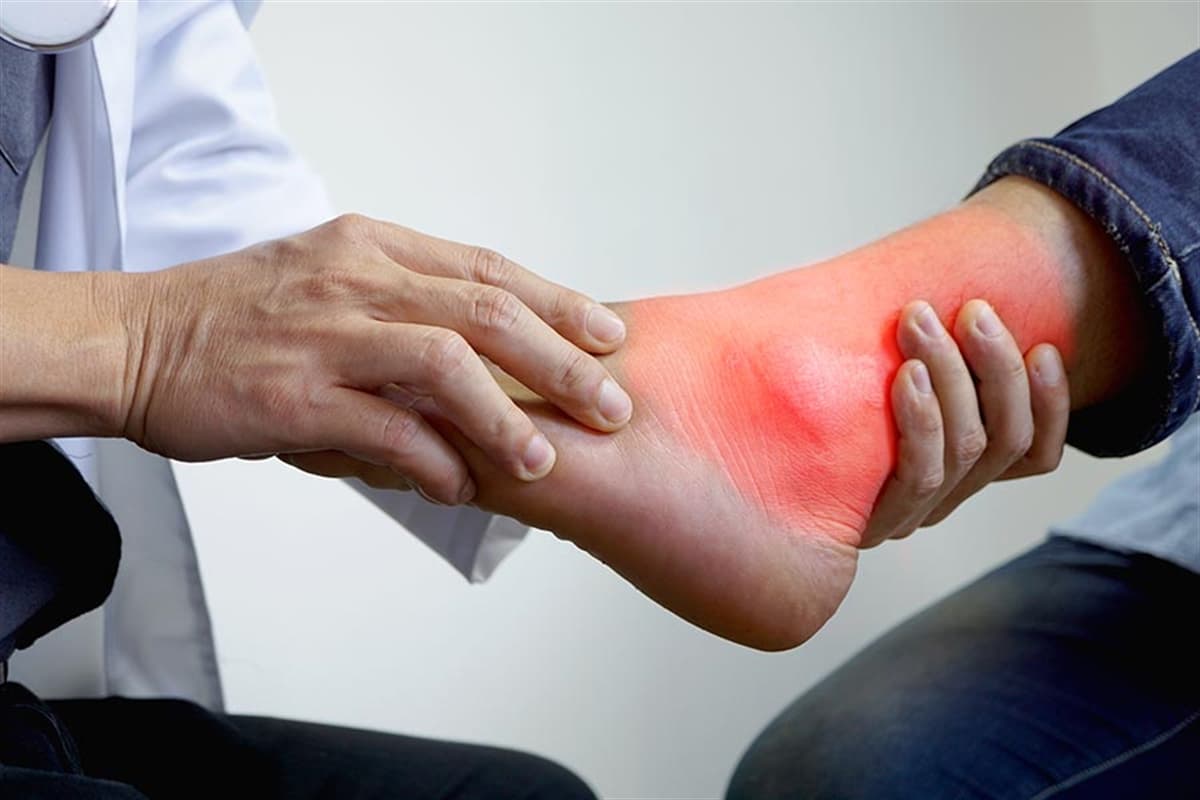 Gut Hastalığı nedir? Gut Hastalığı Belirtiler Nelerdir? Hastalığın Evreleri Nelerdir? Gut Diyeti Nasıl Yapılır? Gut hastalığının tedavisi nedir?