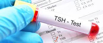 TSH nedir? TSH Ne İşe Yarar? TSH Testi Nedir? TSH Testi Ne Zaman Yapılır? Normal TSH Değeri Kaçtır?  TSH Yüksekliği Ne Anlama Gelir? TSH Yüksekliği Tedavisi nedir? TSH Düşüklüğü Ne Anlama Gelir? TSH Düşüklüğü ile Seyreden Hastalıklarda Tedavi Nasıldı